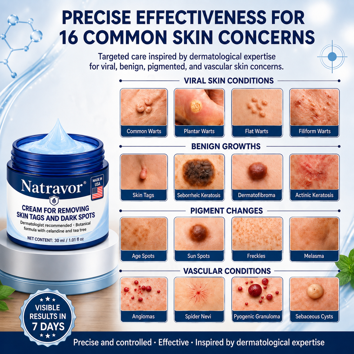 Natravor® 7-𝐃𝐚𝐲 𝐒𝐤𝐢𝐧 𝐓𝐚𝐠 & 𝐒𝐩𝐨𝐭 𝐄𝐫𝐚𝐬𝐞𝐫 𝐂𝐫𝐞𝐚𝐦 (Zero Pain, Zero 𝐒𝐜𝐚𝐫𝐬 Formula)