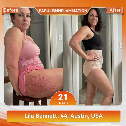 𝐎𝐟𝐟𝐢𝐜𝐢𝐚𝐥 𝐁𝐫𝐚𝐧𝐝 𝐒𝐭𝐨𝐫𝐞 👙 Natravor® 𝟐𝟎𝟐𝟔 𝐌𝐨𝐫𝐢𝐧𝐠𝐚 & 𝐁𝐞𝐫𝐛𝐞𝐫𝐢𝐧𝐞 𝟒-𝐈𝐧-𝟏 𝐌𝐢𝐜𝐫𝐨-𝐏𝐚𝐫𝐭𝐢𝐜𝐥𝐞 𝐒𝐜𝐮𝐥𝐩𝐭𝐢𝐧𝐠 & 𝐅𝐚𝐭-𝐁𝐮𝐫𝐧 𝐒𝐡𝐨𝐫𝐭𝐬