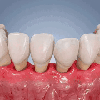 🇺🇸👨‍⚕️🦷🛡️𝗚𝘂𝗺𝗥𝗲𝗻𝗲𝘄 Periodontal Repair Gel