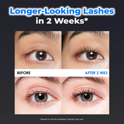 Lash Growth Serum｜Safe Non-Prostaglandin Formula, Fuller Lashes In 2 Weeks