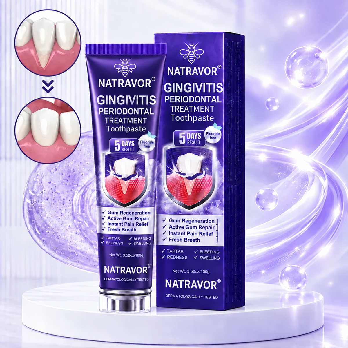 NATRAVOR™ GingivitisPeriodontal Treatment